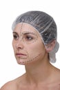 Plastic surgery, face lift Royalty Free Stock Photo