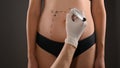 Plastic surgery of the female abdomen Royalty Free Stock Photo