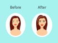 Plastic surgery before and after illustration. Portrait of beautiful girl in cartoon style. Royalty Free Stock Photo