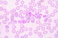 Platelet clumping