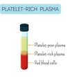 Platelet rich plasma in a glass test tube infographics. Blood composition.