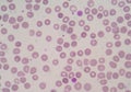 Platelet and white blood cells Royalty Free Stock Photo