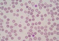 Platelet and white blood cells