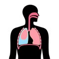 Pleural effusion poster