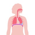 Pleural effusion poster