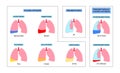 Pleural effusion poster