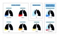 Pleural effusion poster