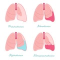 Pleural effusions of human lung. Fluid or air in pleural cavity - vector anatomical scheme. Comparison some types