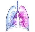 Pneumonia, an ailment impacting lungs, inflames bronchi, alveoli, and trachea. Concept illustration