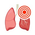 Pneumonia asthma lung pulmonary vector inflamed bronchial asthma tuberculosis illustration. Lung health human disease