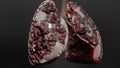 Pneumonia illness, healthy lungs and disease lungs, Human Lungs cancer, Cigarette smokers Lung disease, asthma infection