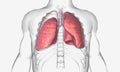 Pneumothorax is a pulmonary condition in which air accumulates around the lungs