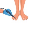 Podiatry concept. Feet treatment. Hardware medical pedicure.