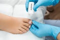 Podologist uses antibiotic powder after removal of ingrown toe nail Royalty Free Stock Photo