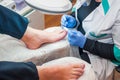 Podology treatment. Podiatrist treating toenail fungus. Doctor removes calluses, corns and treats ingrown nail. Hardware manicure.