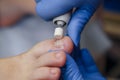 Podology treatment. Podiatrist treating toenail fungus. Doctor removes calluses, corns and treats ingrown nail. Hardware