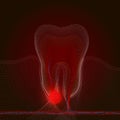 Point styling with a point of pain and inflammation. Medical illustration of tooth root inflammation, tooth root cyst, pulpitis. X