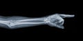 Pointing X-ray hand Royalty Free Stock Photo