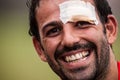 POINTNOIRE/CONGO - 18MAY2013 - Expressive portrait of injured rugby player