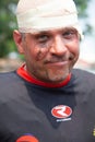 POINTNOIRE/CONGO - 18MAY2013 - Expressive portrait of injured rugby player