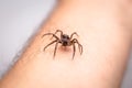 Poisonous spider over person arm, poisonous spider biting person, concept of arachnophobia, fear of spider. Spider Bite