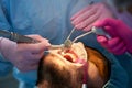 Polishing teeth patient using cofferdam. Dental services in clinic. Close-up