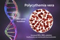 Polycythemia vera, a rare slow-growing blood cancer with an increase in the number of red blood cells