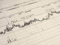 Polysomnography PSG sleep study