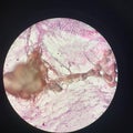 polytene chromosomes in fruit flies. a special form of chromosome