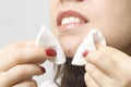 Popping a zit Royalty Free Stock Photo