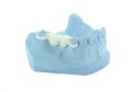 Porcelain bridge on blue model Royalty Free Stock Photo