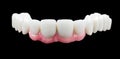 Porcelain teeth Royalty Free Stock Photo