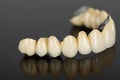 Porcelain teeth - dental bridge Royalty Free Stock Photo