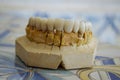 Porcelain teeth