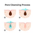 Pore Cleansing Process A Step-by-Step Guide to Clear Skin Royalty Free Stock Photo