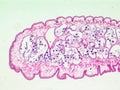 Pork tapeworm Taenia solium