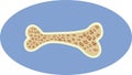 Vector Illustration of a Bone Suffering from Aging and Osteoporosis Royalty Free Stock Photo