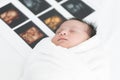 Portrait of Asian Australian newborn baby less than one month old wrapped with cotton towel sleeping on bed with fetal ultrasound Royalty Free Stock Photo