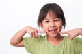 Portrait of an Asian girl with broken upper baby teeth and first permanent teeth. Friendly little girl showing her broken teeth