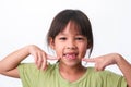 Portrait of an Asian girl with broken upper baby teeth and first permanent teeth. Friendly little girl showing her broken teeth