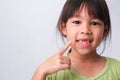 Portrait of an Asian girl with broken upper baby teeth and first permanent teeth. Friendly little girl showing her broken teeth