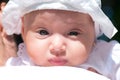 Portrait of a baby girl with blocked tear ducts of one eye