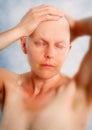 Portrait of a balding woman with cancer Royalty Free Stock Photo