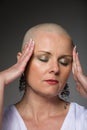 Beautiful woman cancer patient without hair Royalty Free Stock Photo