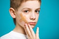 Portrait of a boy with adhesive plaster on his cheek