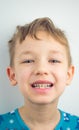 Portrait of a boy in pajamas, bad teeth, closeup Royalty Free Stock Photo