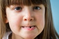 Portrait of cute girl losing her first milk tooth. Close up