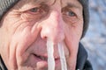 Portrait of an elderly man with icicles in his nose. The man`s snot was frozen in his nose. Runny nose in the winter forest. Frost