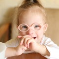 Portrait of a girl with Down syndrome Royalty Free Stock Photo