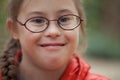Portrait of a girl with special needs in glasses close-up
